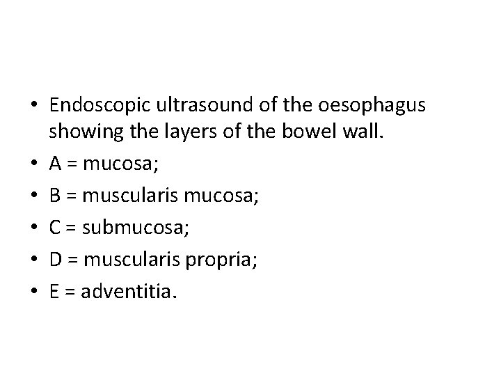  • Endoscopic ultrasound of the oesophagus showing the layers of the bowel wall.