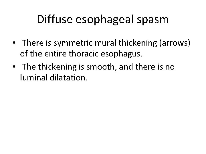 Diffuse esophageal spasm • There is symmetric mural thickening (arrows) of the entire thoracic