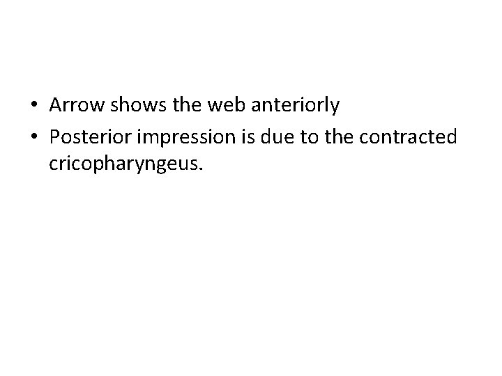  • Arrow shows the web anteriorly • Posterior impression is due to the