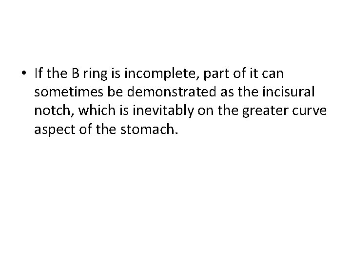  • If the B ring is incomplete, part of it can sometimes be