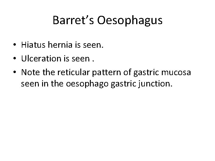 Barret’s Oesophagus • Hiatus hernia is seen. • Ulceration is seen. • Note the