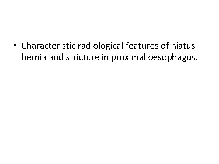  • Characteristic radiological features of hiatus hernia and stricture in proximal oesophagus. 