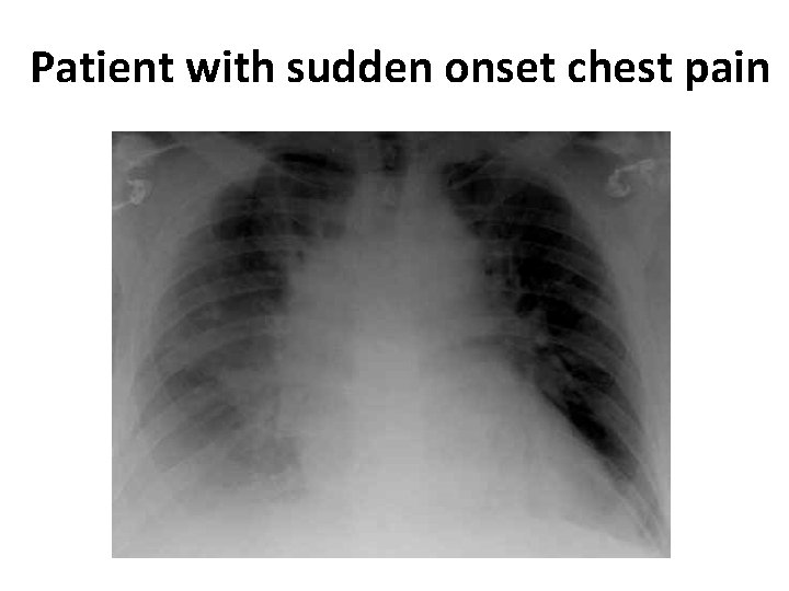 Patient with sudden onset chest pain 
