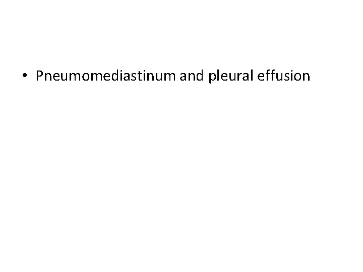  • Pneumomediastinum and pleural effusion 