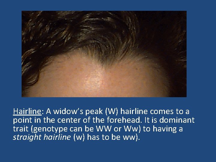 Hairline: A widow’s peak (W) hairline comes to a point in the center of