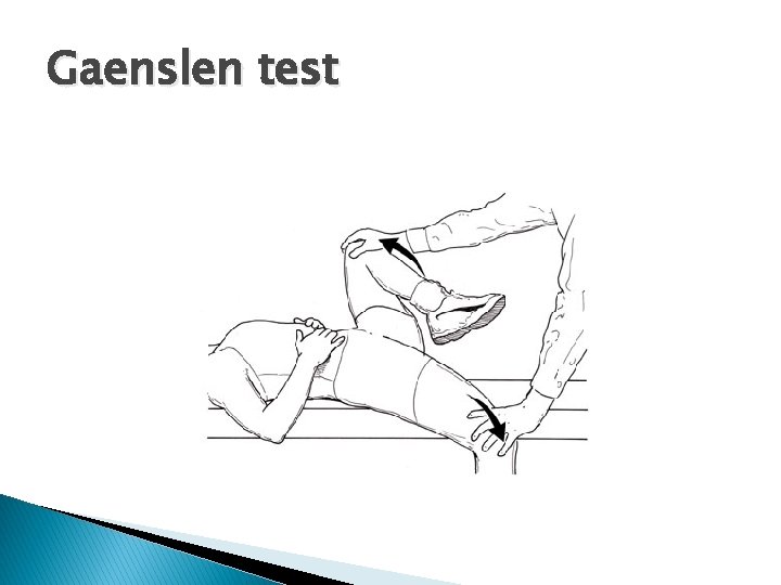 Gaenslen test 