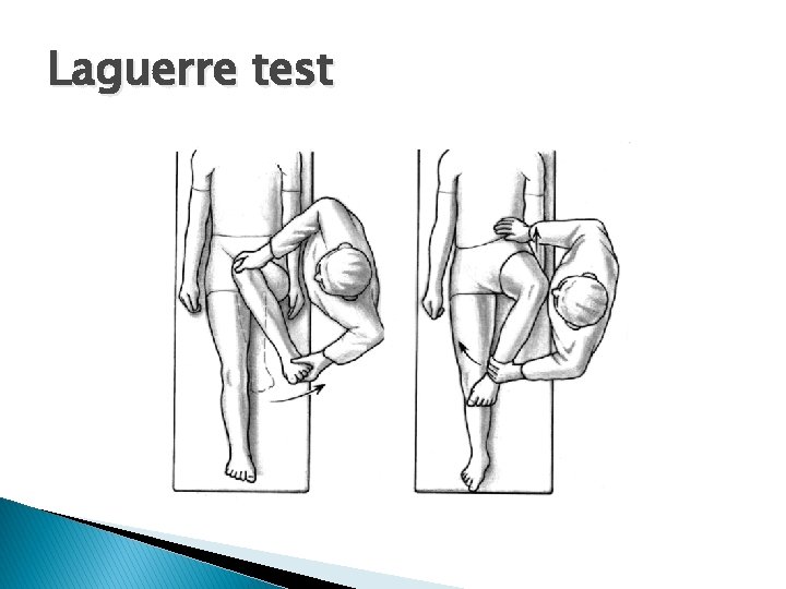 Laguerre test 