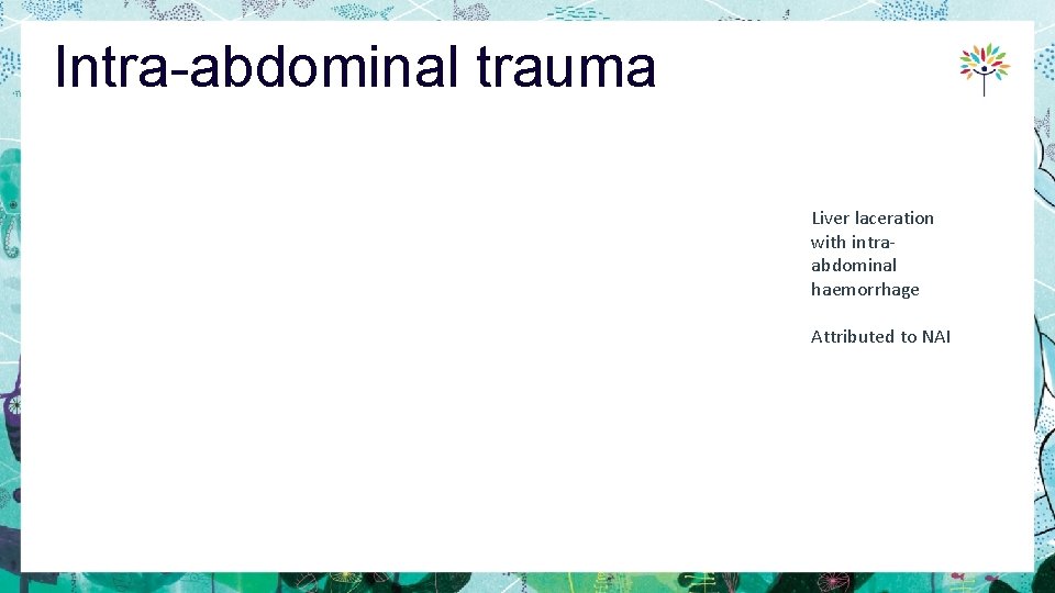 Intra-abdominal trauma Liver laceration with intraabdominal haemorrhage Attributed to NAI 
