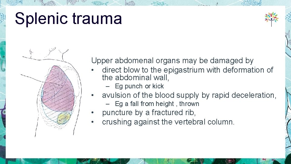 Splenic trauma Upper abdomenal organs may be damaged by • direct blow to the