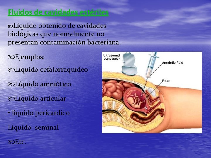 Fluidos de cavidades estériles Líquido obtenido de cavidades biológicas que normalmente no presentan contaminación