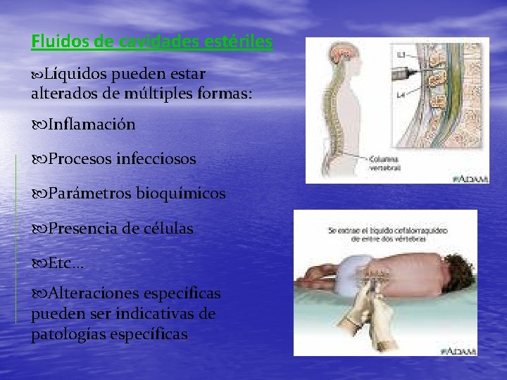 Fluidos de cavidades estériles Líquidos pueden estar alterados de múltiples formas: Inflamación Procesos infecciosos