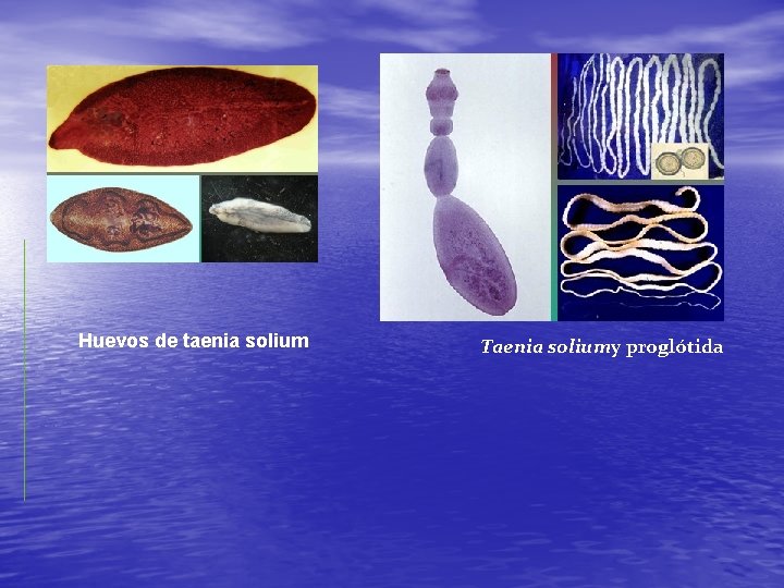 Huevos de taenia solium Taenia soliumy proglótida 