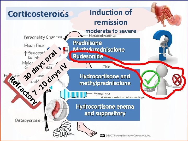 Corticosteroids Induction of remission moderate to severe s y a d 0 l a