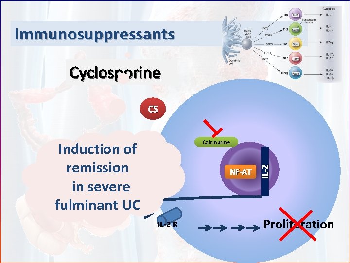 Immunosuppressants Cyclosporine CS Induction of remission in severe fulminant UC NF-AT IL-2 R IL-2