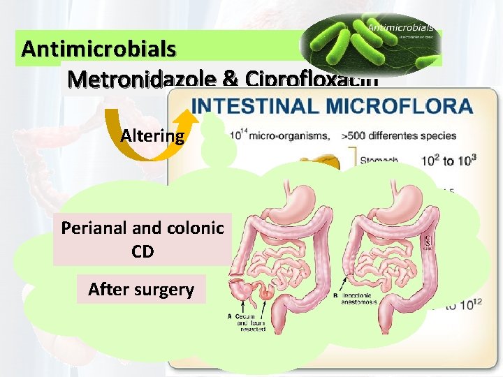 Antimicrobials Metronidazole & Ciprofloxacin Altering Perianal and colonic CD After surgery 