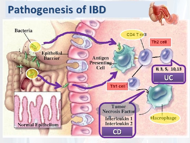 Pathogenesis of IBD IL 3, 5, 10, 13 UC CD 
