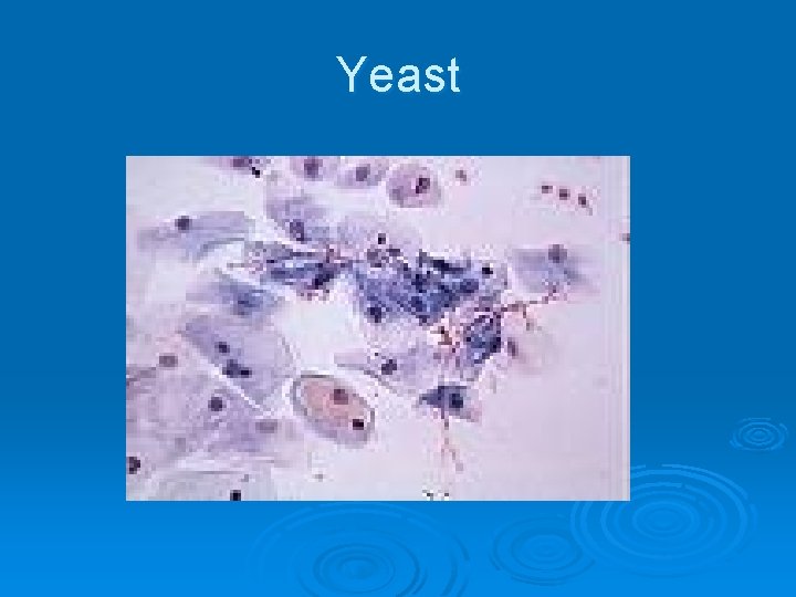 Yeast 