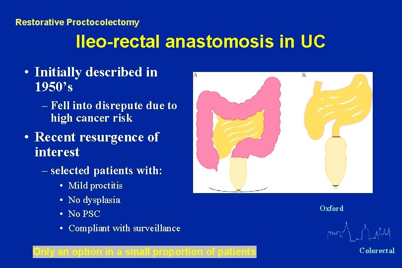 Restorative Proctocolectomy Ileo-rectal anastomosis in UC • Initially described in 1950’s – Fell into