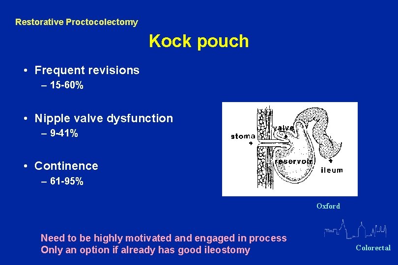 Restorative Proctocolectomy Kock pouch • Frequent revisions – 15 -60% • Nipple valve dysfunction