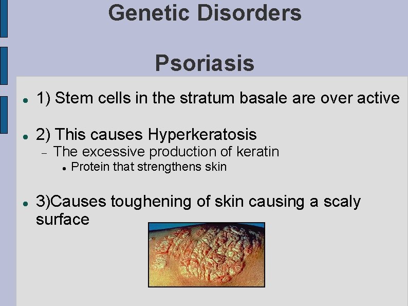 Genetic Disorders Psoriasis 1) Stem cells in the stratum basale are over active 2)