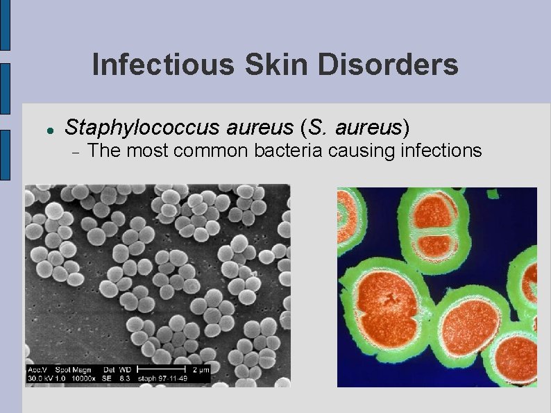 Infectious Skin Disorders Staphylococcus aureus (S. aureus) The most common bacteria causing infections 