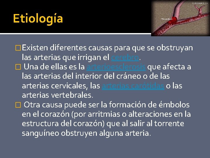 Etiología �Existen diferentes causas para que se obstruyan las arterias que irrigan el cerebro.