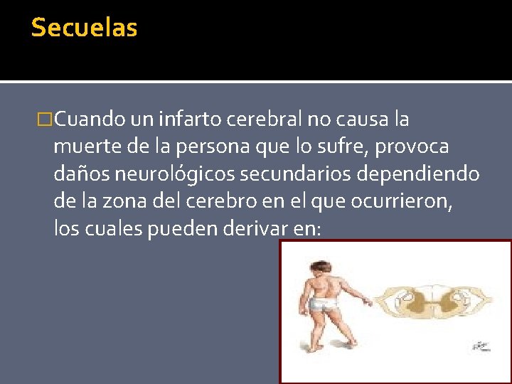 Secuelas �Cuando un infarto cerebral no causa la muerte de la persona que lo