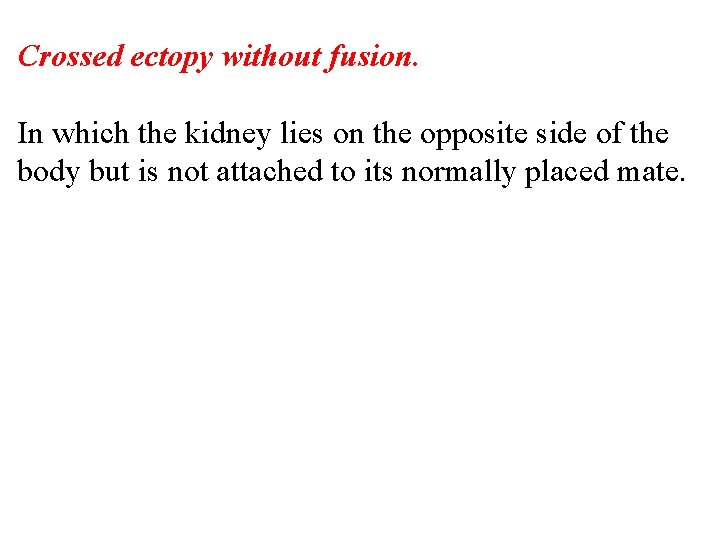 Crossed ectopy without fusion. In which the kidney lies on the opposite side of