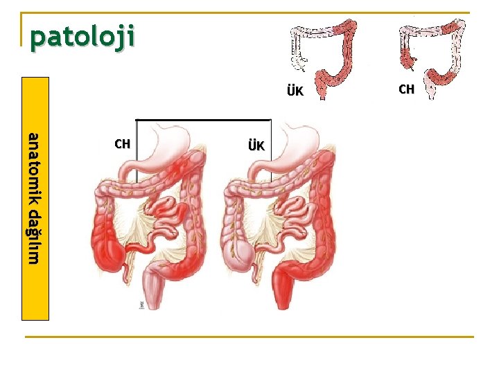 patoloji ÜK a na t o mik d a ğ ıl ım CH CH