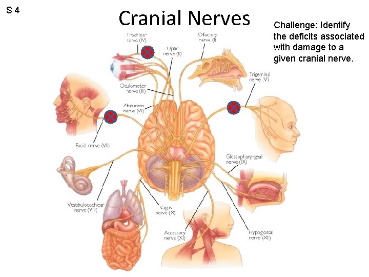S 4 Cranial Nerves Challenge: Identify the deficits associated with damage to a given