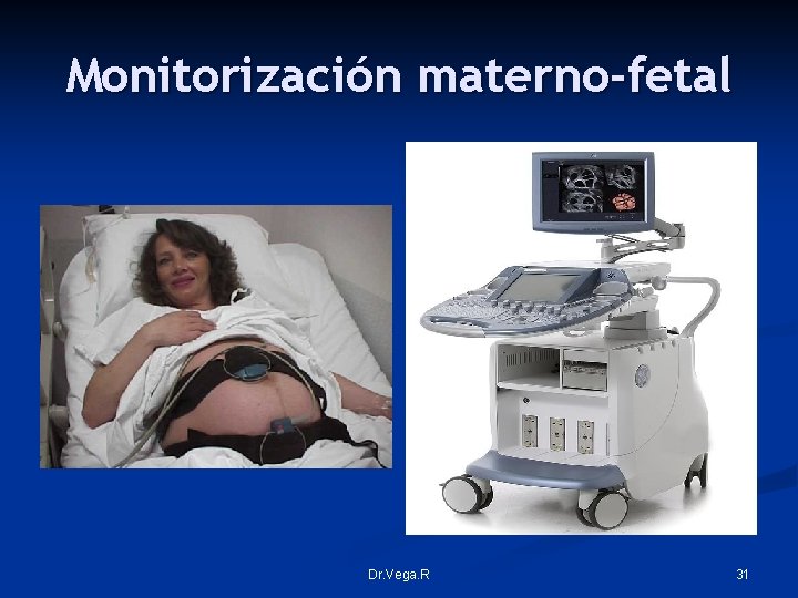 Monitorización materno-fetal Dr. Vega. R 31 