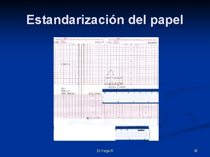 Estandarización del papel 3 Dr. Vega. R 36 