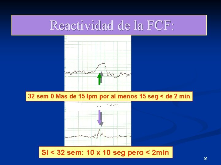 Reactividad de la FCF: 32 sem 0 Mas de 15 lpm por al menos