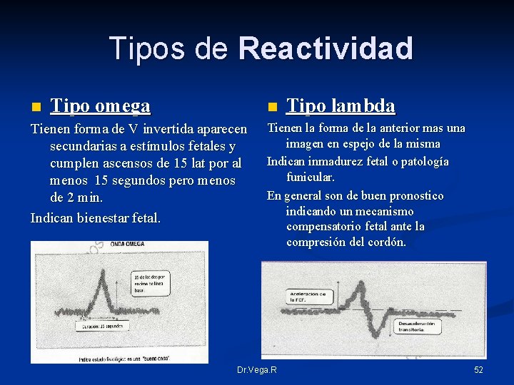 Tipos de Reactividad n Tipo omega Tienen forma de V invertida aparecen secundarias a