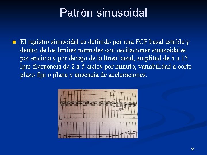 Patrón sinusoidal n El registro sinusoidal es definido por una FCF basal estable y