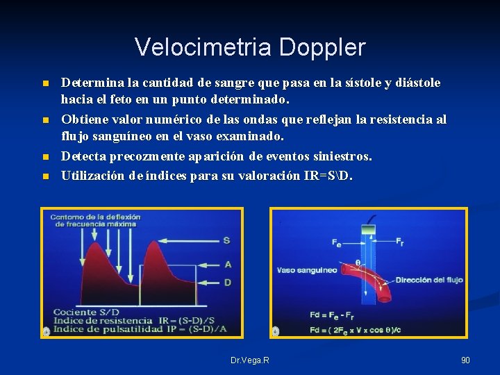 Velocimetria Doppler n n Determina la cantidad de sangre que pasa en la sístole