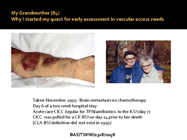 My Grandmother (84) Why I started my quest for early assessment in vascular access