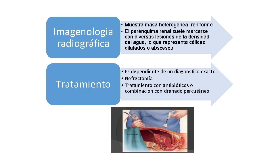 Imagenologia radiográfica Tratamiento • Muestra masa heterogénea, reniforme • El parénquima renal suele marcarse