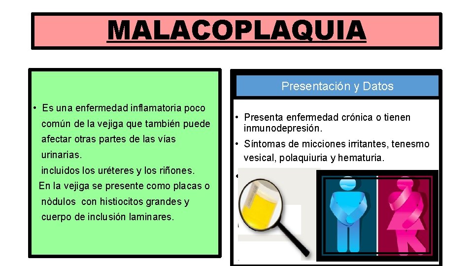 MALACOPLAQUIA Presentación y Datos • Es una enfermedad inflamatoria poco común de la vejiga