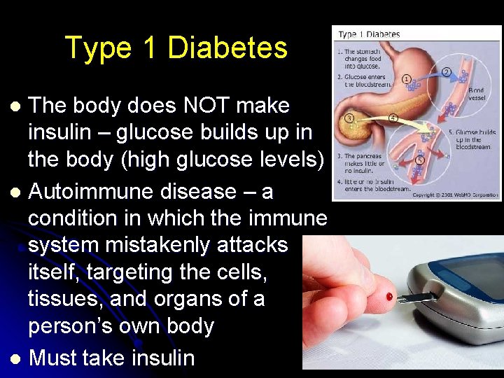 Type 1 Diabetes The body does NOT make insulin – glucose builds up in