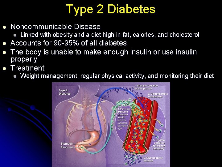 Type 2 Diabetes l Noncommunicable Disease l l Linked with obesity and a diet