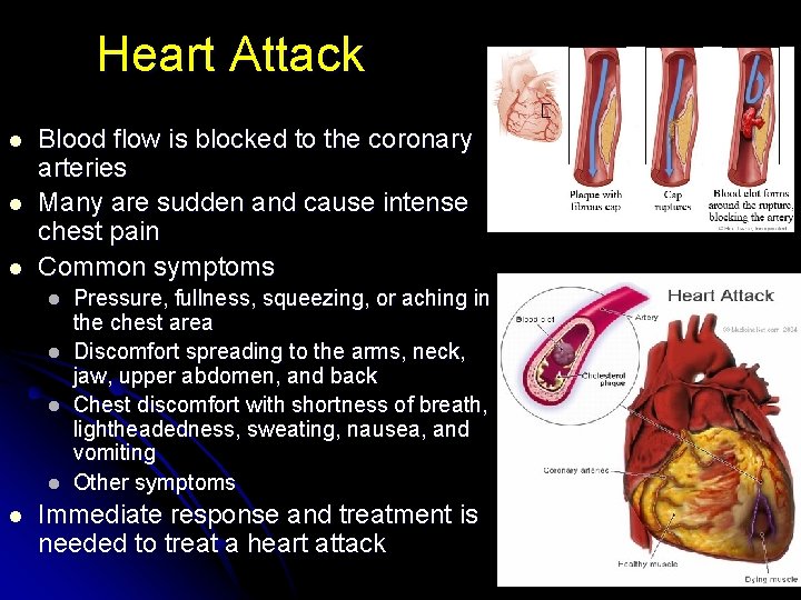 Heart Attack l l l Blood flow is blocked to the coronary arteries Many