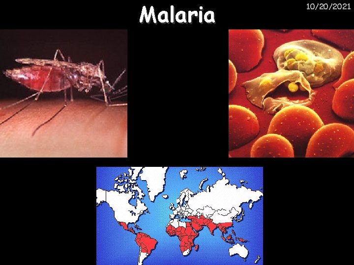 Malaria 10/20/2021 