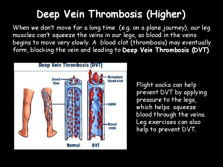 Deep Vein Thrombosis (Higher) When we don’t move for a long time (e. g.