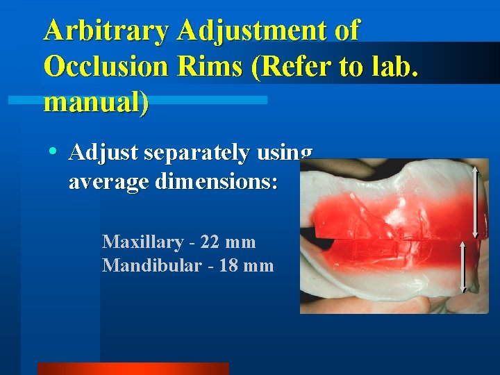 Arbitrary Adjustment of Occlusion Rims (Refer to lab. manual) Adjust separately using average dimensions: