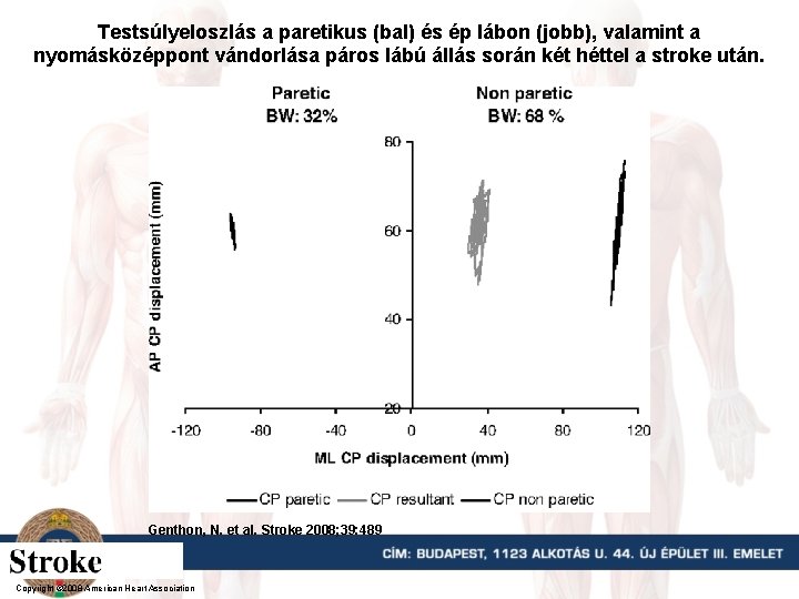 Testsúlyeloszlás a paretikus (bal) és ép lábon (jobb), valamint a nyomásközéppont vándorlása páros lábú