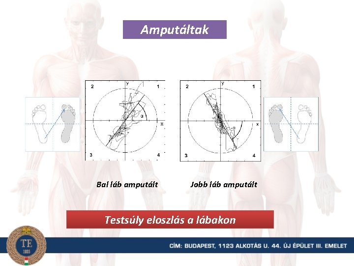 Amputáltak Bal láb amputált Jobb láb amputált Testsúly eloszlás a lábakon 