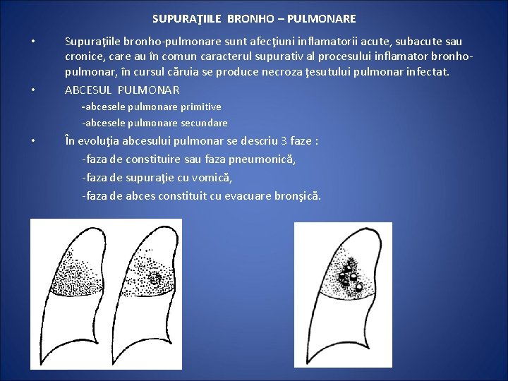 SUPURAŢIILE BRONHO – PULMONARE • • Supuraţiile bronho-pulmonare sunt afecţiuni inflamatorii acute, subacute sau