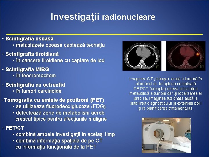 Investigaţii radionucleare • Scintigrafia osoasă • metastazele osoase captează tecneţiu • Scintigrafia tiroidiană •