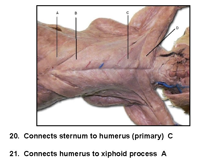 20. Connects sternum to humerus (primary) C 21. Connects humerus to xiphoid process A